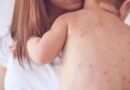 IKSHP: 8 raste me fruth, thirrje prindërve t’i vaksinojnë fëmijët