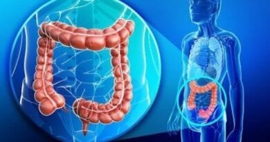 Kanceri i zorrës së trashë shkaktari kryesor i vdekjeve nga kjo sëmundje te nën 50-vjeçarët në SHBA