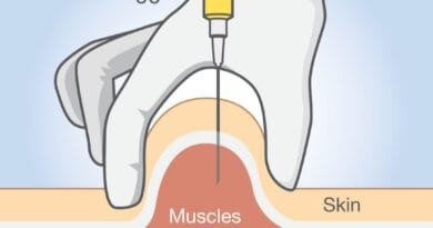 Injeksionet intramuskulare dhe rreziqet e fshehura