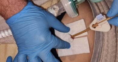 Kujdesi profesional për PEG – një domosdoshmëri për sigurinë e pacientit